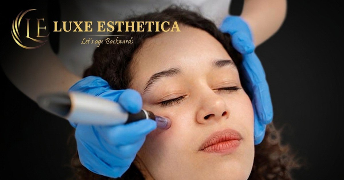 Dermapen Treatment