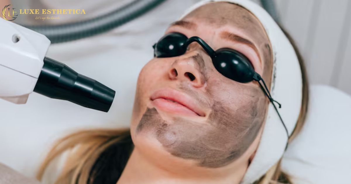 Top 10 Benefits of a Carbon Facial Treatment