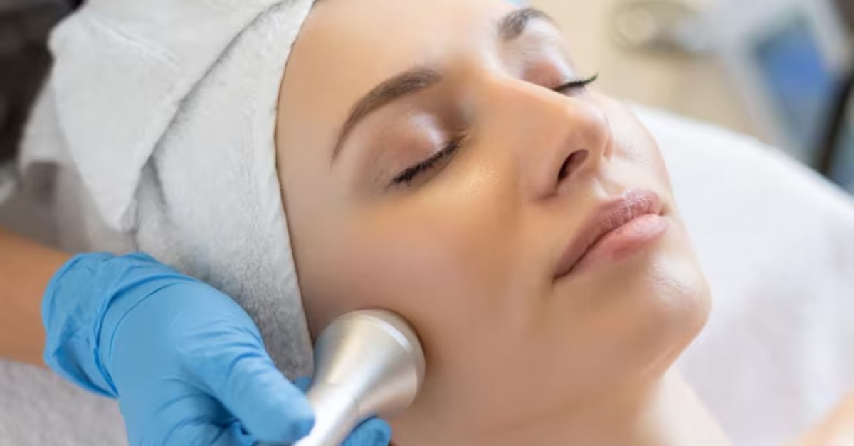 photo Facial benefits