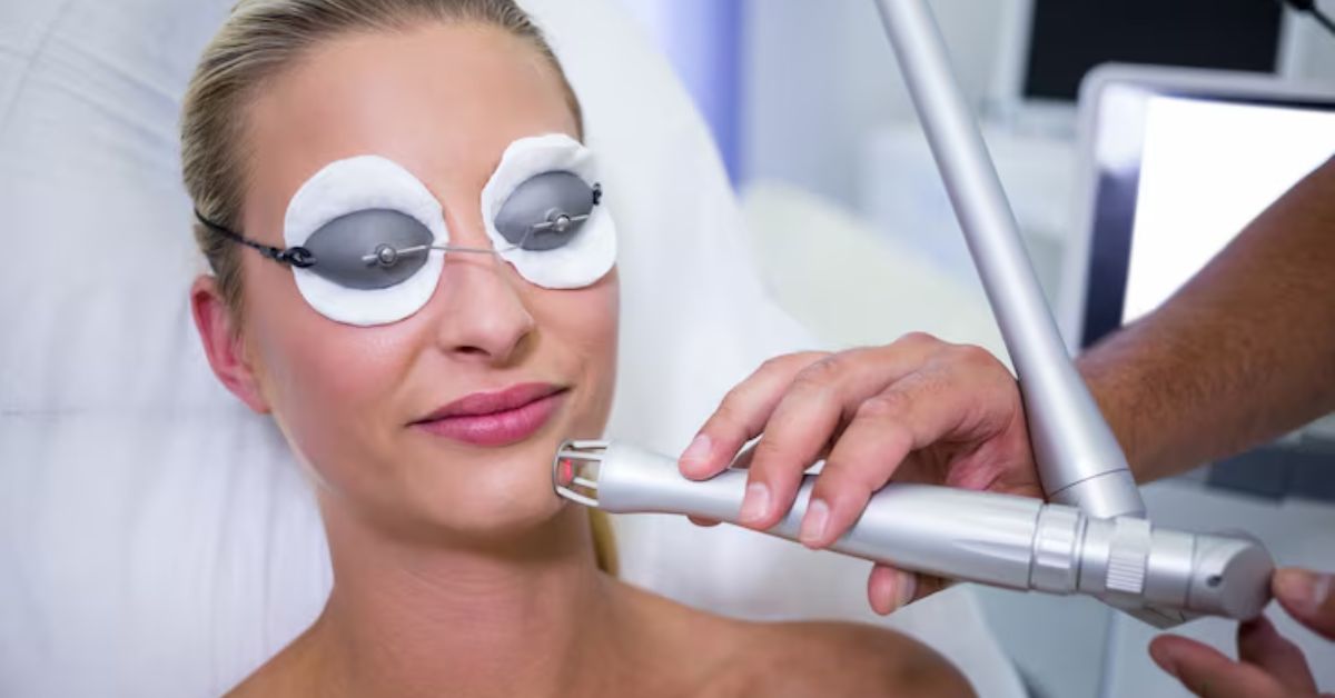 photo facial treatment